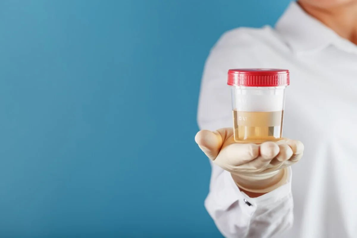 A healthcare worker holding a urine sample in a sealed container against a blue background.